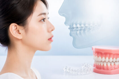 강남 돌출입 교정 옆모습 — 입과 치아가 돌출된 돌출입 상태 센트럴치과 강남점