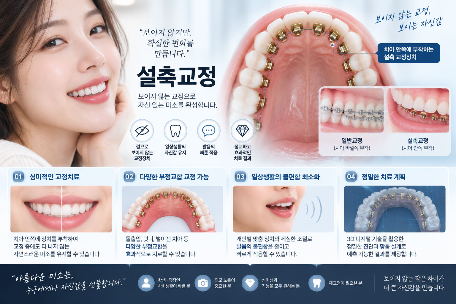 신논현역 설측교정 — 치아 안쪽에 부착해 보이지 않는 교정 센트럴치과 강남점