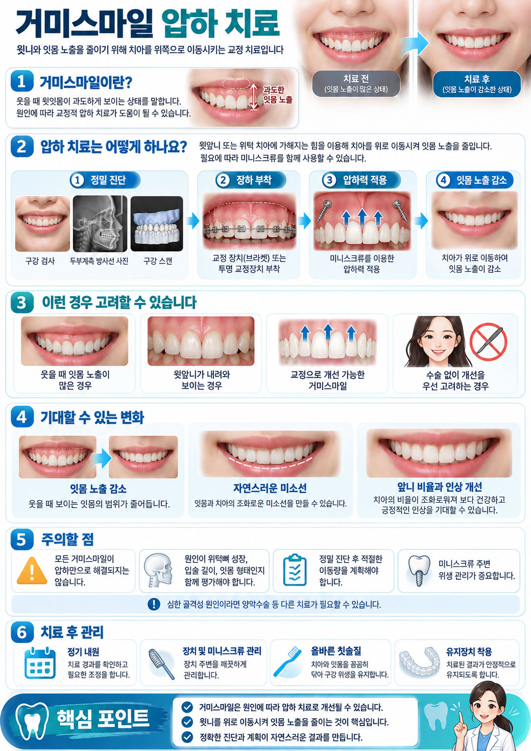 거미스마일 압하 — 앞니 압하와 전체 치열 압하의 차이 신논현역 센트럴치과 강남점
